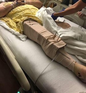 leg.jpg