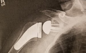 thumbnail_20190403_062648.jpg